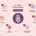 Breaking Down IVF Costs: What Each Stage of Treatment Really Costs