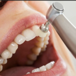 The Importance of Regular Cleanings From the Dentist