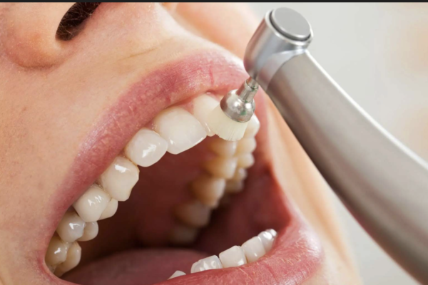 The Importance of Regular Cleanings From the Dentist
