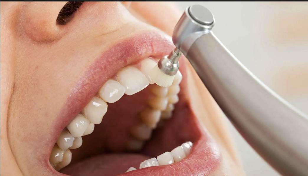 The Importance of Regular Cleanings From the Dentist